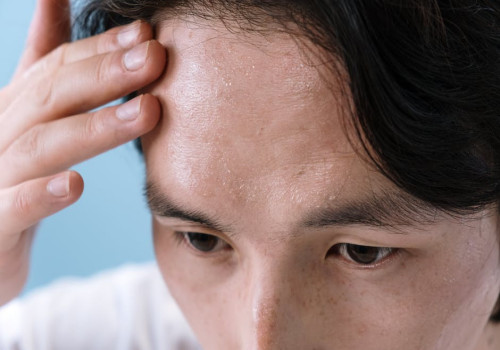 Zeg vaarwel tegen zweet met deze handige tips